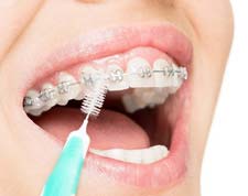 ADDC-Oral-Hygiene-Interdental-brushes