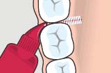 How to use Interdental Brush