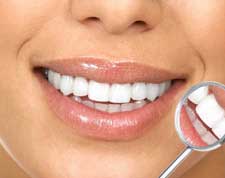Treatments-quick-straight-teeth-small-1