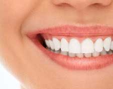 Treatments-teeth-whitening-small-1