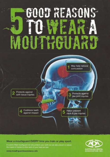 mouthguards perth
